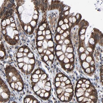 Anti-SLIRP antibody produced in rabbit Prestige Antibodies&#174; Powered by Atlas Antibodies, affinity isolated antibody, buffered aqueous glycerol solution