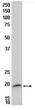 Anti-LIM Domain Only 2 Antibody, clone 2E6 culture supernatant, clone 2E6, Chemicon&#174;