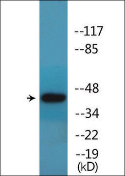 Anti-phospho-p53 (pSer46) antibody produced in rabbit affinity isolated antibody