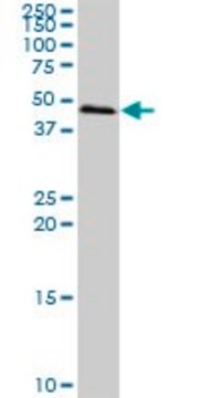 Anti-SCP2 antibody produced in mouse purified immunoglobulin, buffered aqueous solution