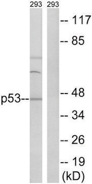 Anti-p53 antibody produced in rabbit affinity isolated antibody