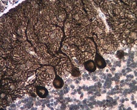 Anti-InsP3R-Antikörper, Typ&nbsp;1 from rabbit, purified by affinity chromatography