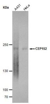 Monoklonalny anty-CEP152 clone GT1315, affinity isolated antibody