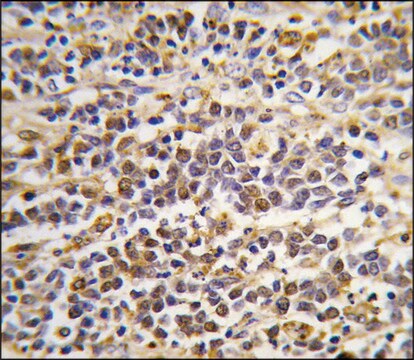 Anti-ALDH1A3 (center) antibody produced in rabbit saturated ammonium sulfate (SAS) precipitated, buffered aqueous solution