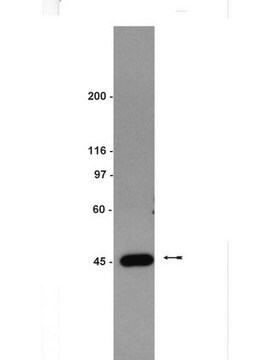 Anti-IKK&#947; Antibody Upstate&#174;, from mouse