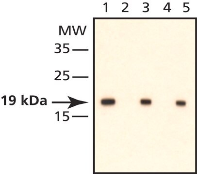 Monoclonal Ant-phospho-Cofilin (pSer3) antibody produced in rabbit IgG fraction of antiserum, buffered aqueous solution