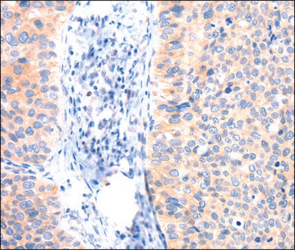 Anti-ANK3 antibody produced in rabbit affinity isolated antibody