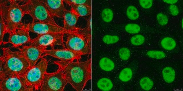 Anti-TATA-Binding-Protein Antibody ascites fluid, Chemicon&#174;