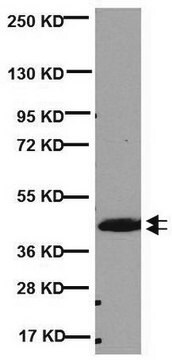 Anti-CNPase-Antikörper, Klon 11-5B clone 11-5B, Chemicon&#174;, from mouse