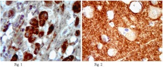 Anti-Cholesterol acyltransferase 1 Antibody from rabbit, purified by affinity chromatography