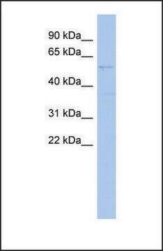 Anti-SMYD2 antibody produced in rabbit affinity isolated antibody