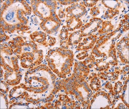 Anti-ADAMTS17 antibody produced in rabbit affinity isolated antibody