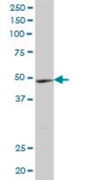 抗YTHDF2抗体 マウス宿主抗体 IgG fraction of antiserum, buffered aqueous solution