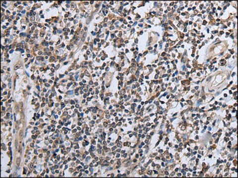 Anti-CXCL6 affinity isolated antibody