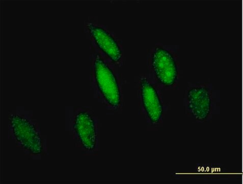 Anti-GSTO1 antibody produced in mouse purified immunoglobulin, buffered aqueous solution