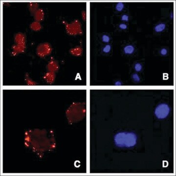 Anti-ASPORIN/ASPN antibody produced in goat affinity isolated antibody, buffered aqueous solution