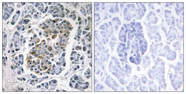 Anti-MTSSB antibody produced in rabbit affinity isolated antibody