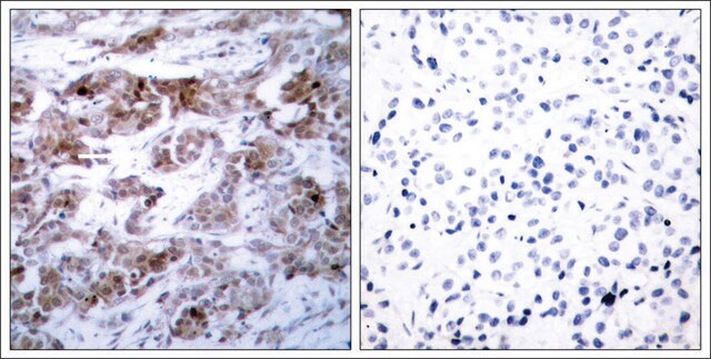 Anti-BCL2 (Ab-70) antibody produced in rabbit affinity isolated antibody