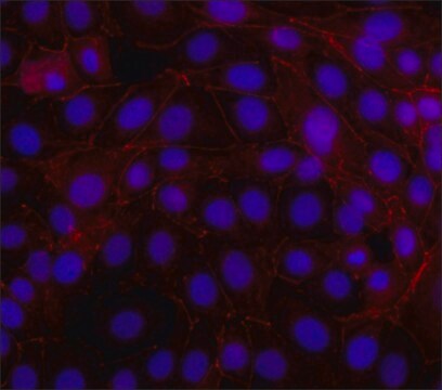 Anti-&#946;-Catenin&#8722;Cy3 antibody, Mouse monoclonal clone 15B8, purified from hybridoma cell culture