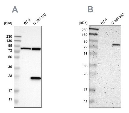 抗ALDH18A1 ウサギ宿主抗体 Prestige Antibodies&#174; Powered by Atlas Antibodies, affinity isolated antibody, buffered aqueous glycerol solution