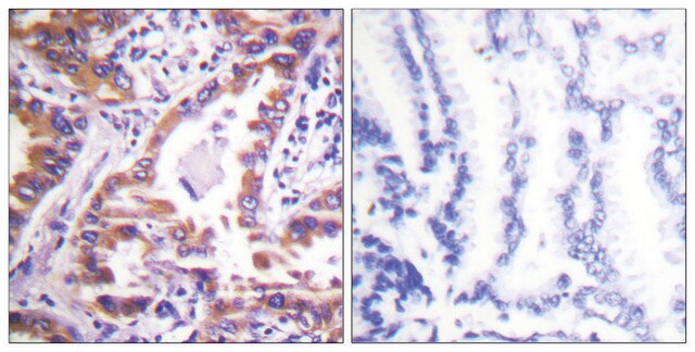 Anti-Calnexin, C-Terminal antibody produced in rabbit affinity isolated antibody