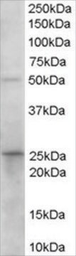 Anti-Prostaglandin Dehydrogenase 1 antibody produced in goat affinity isolated antibody, buffered aqueous solution