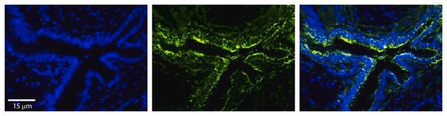 Anti-PLOD2 antibody produced in rabbit affinity isolated antibody