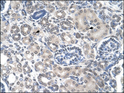 Anti-PPAT antibody produced in rabbit affinity isolated antibody