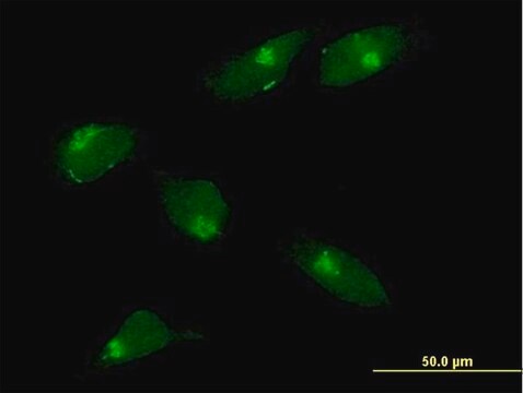 抗MGAT1抗体 マウス宿主抗体 IgG fraction of antiserum, buffered aqueous solution