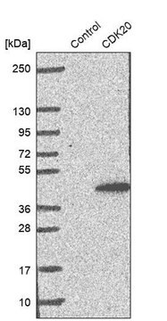 Anti-CDK20 antibody produced in rabbit Prestige Antibodies&#174; Powered by Atlas Antibodies, affinity isolated antibody, buffered aqueous glycerol solution, ab3