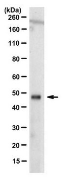 Anti-OTUD3 Antibody, clone 12A6.1 clone 12A6.1, from mouse