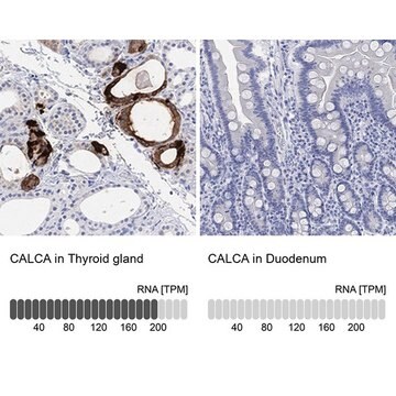 Anti-CALCA Prestige Antibodies&#174; Powered by Atlas Antibodies, affinity isolated antibody, buffered aqueous glycerol solution