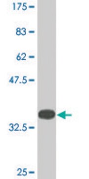 Monoclonal Anti-JARID1B antibody produced in mouse clone 1G10, ascites fluid