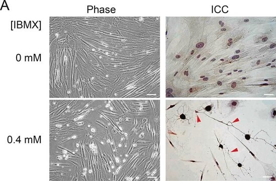 Anti-Neuron-Specific Enolase (NSE), Mouse monoclonal clone NSE-P1, purified from hybridoma cell culture