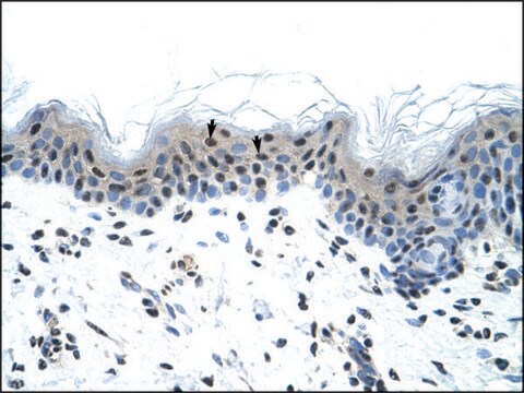 Anti-SCN5A antibody produced in rabbit affinity isolated antibody