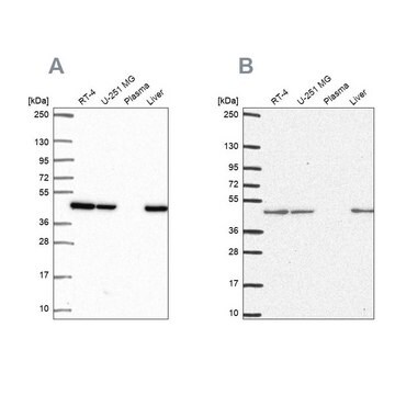 抗NDUFS2抗体 ウサギ宿主抗体 Prestige Antibodies&#174; Powered by Atlas Antibodies, affinity isolated antibody, buffered aqueous glycerol solution