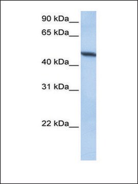 Anti-ADAM33 antibody produced in rabbit affinity isolated antibody