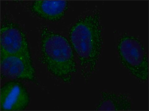 Anti-AMSH-LP/STAMBPL1 antibody produced in rabbit ~1.0&#160;mg/mL, affinity isolated antibody