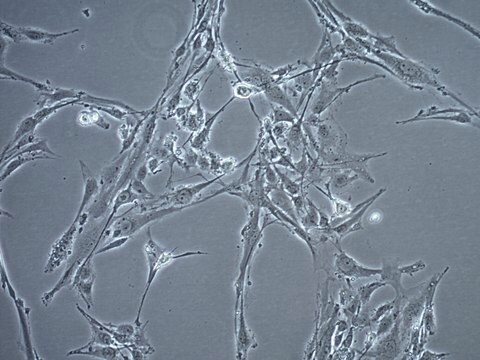 TB096 Human IDH1-Mutated Astrocytoma Cell Line