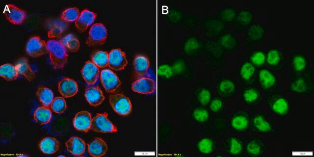 Anti-IRF-4 Antibody, clone 1E10 ZooMAb&#174; Rabbit Monoclonal recombinant, expressed in HEK 293 cells