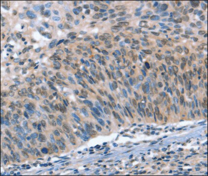 Anti-CAMTA1 antibody produced in rabbit affinity isolated antibody