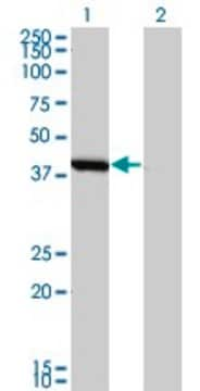 Monoclonal Anti-SMS antibody produced in mouse clone 1G6, purified immunoglobulin, buffered aqueous solution