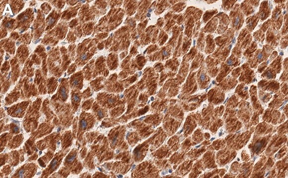 Anti-SDHA Antibody, clone 1G16 ZooMAb&#174; Rabbit Monoclonal recombinant, expressed in HEK 293 cells