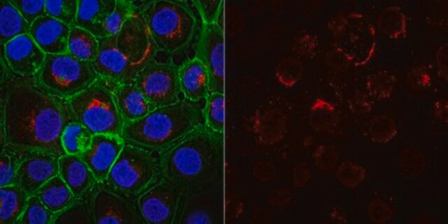 Przeciwciało przeciw cytokeratynie 5,6, klon D5/16B4, Alexa Fluor&#8482; 555 clone D5/16B4, from mouse, ALEXA FLUOR&#8482; 555