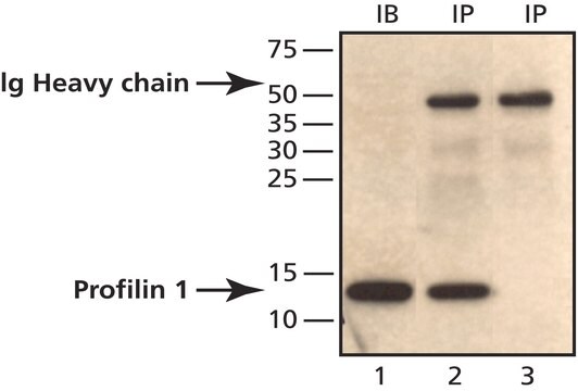 Anti-Profilin 1 (C-terminal) 兔抗 ~1&#160;mg/mL, affinity isolated antibody, buffered aqueous solution