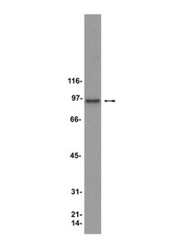 Anti-HSP90-Antikörper clone D7a, Upstate&#174;, from mouse