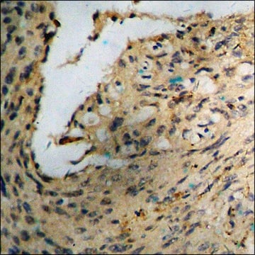 抗 磷酸化 Akt (pSer 473 ) 兔抗 affinity isolated antibody