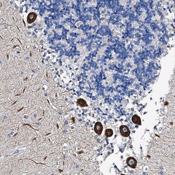 Anti-FREM3 antibody produced in rabbit Prestige Antibodies&#174; Powered by Atlas Antibodies, affinity isolated antibody, buffered aqueous glycerol solution