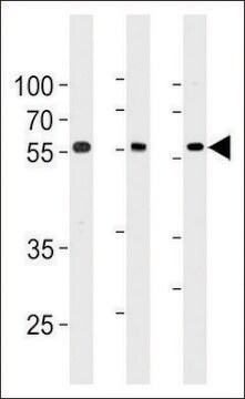 ANTI-TRIM6 (N-TERMINAL) antibody produced in rabbit affinity isolated antibody, buffered aqueous solution