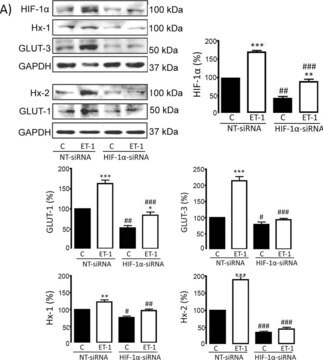 Anti-Glucose Transporter GLUT-3 Antibody, CT serum, Chemicon&#174;